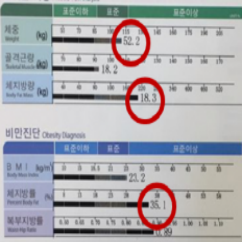 치료 후
