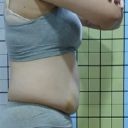 치료 후