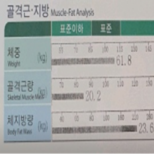 치료 전