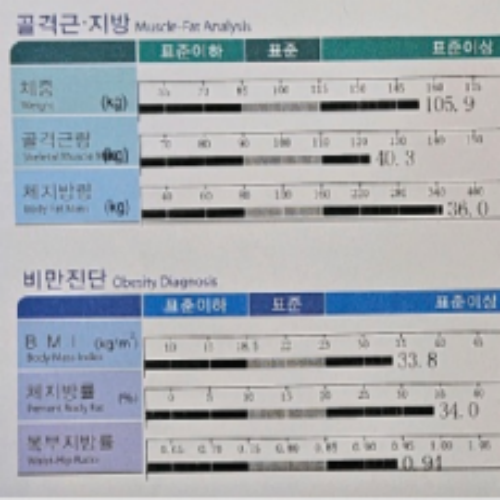 치료 전