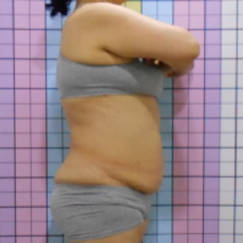 치료 전