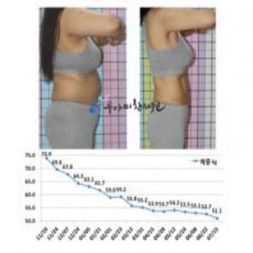 치료 전