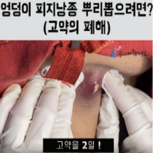 치료 전