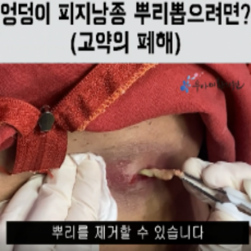 치료 후