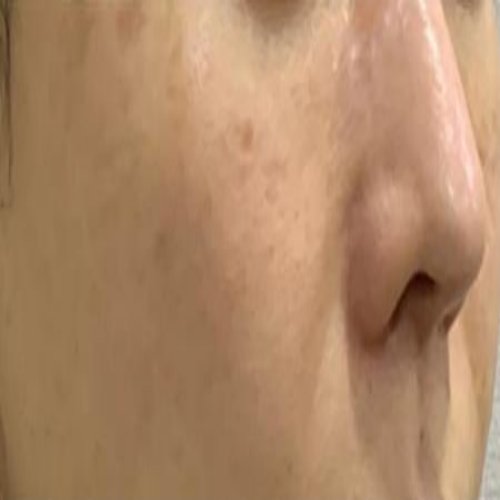 치료 후