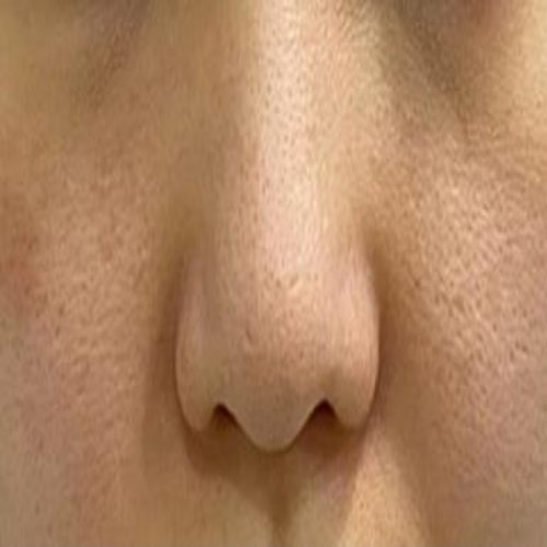치료 후