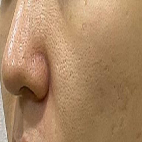 치료 전