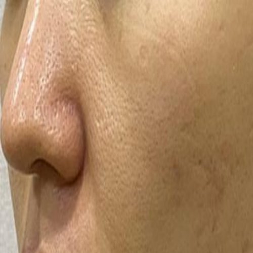 치료 후