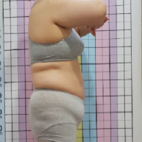 치료 전