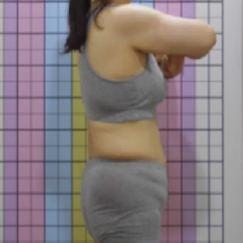 치료 후