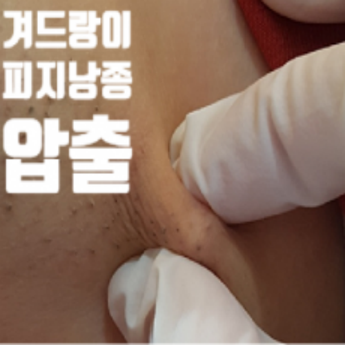 치료 전
