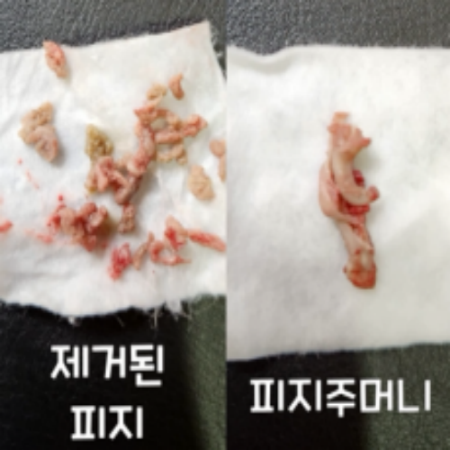 치료 후
