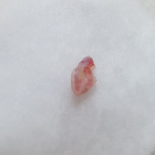 치료 후