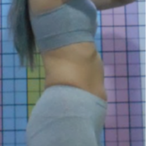 치료 전