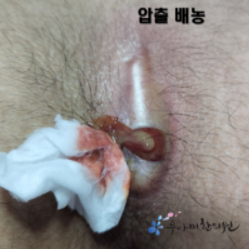치료 후