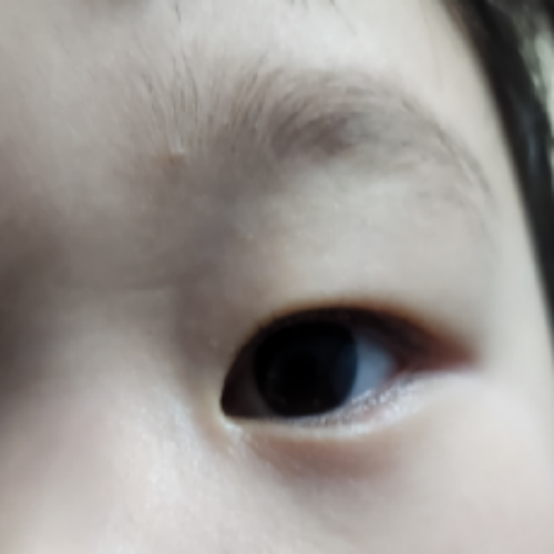 치료 후