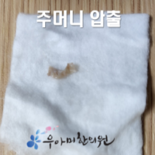 치료 후