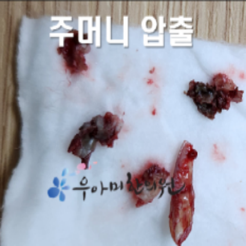 치료 후