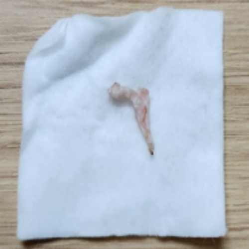 치료 후