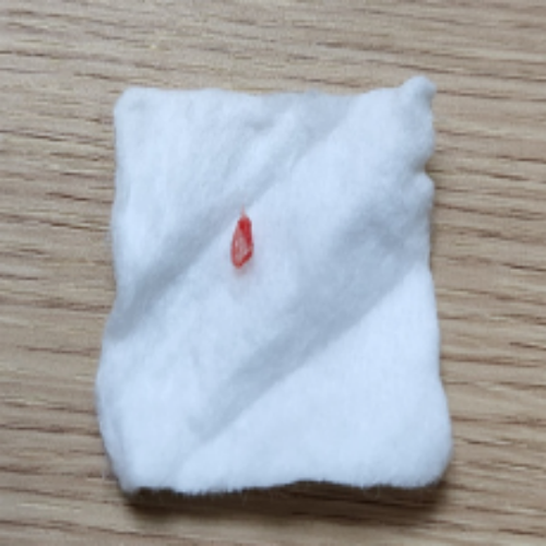 치료 후