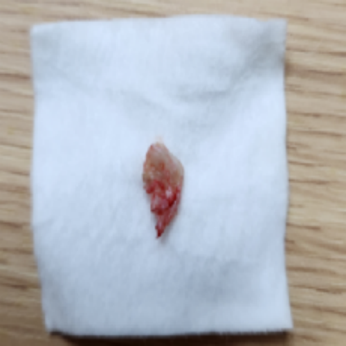 치료 후