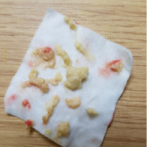 치료 전