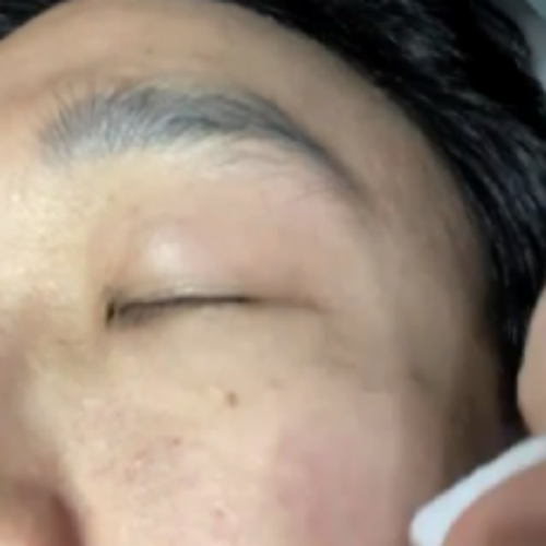 치료 전