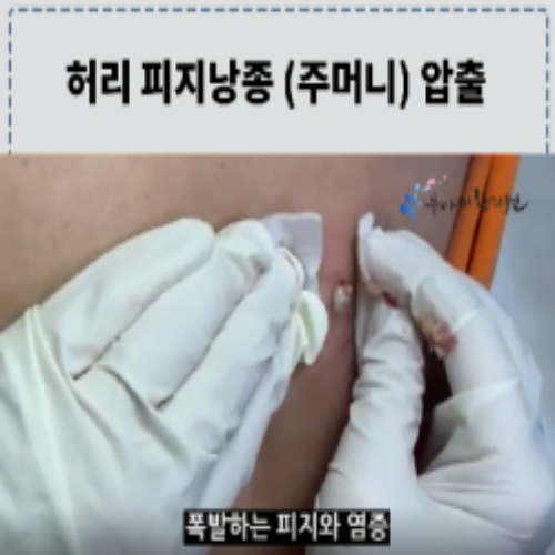 치료 전