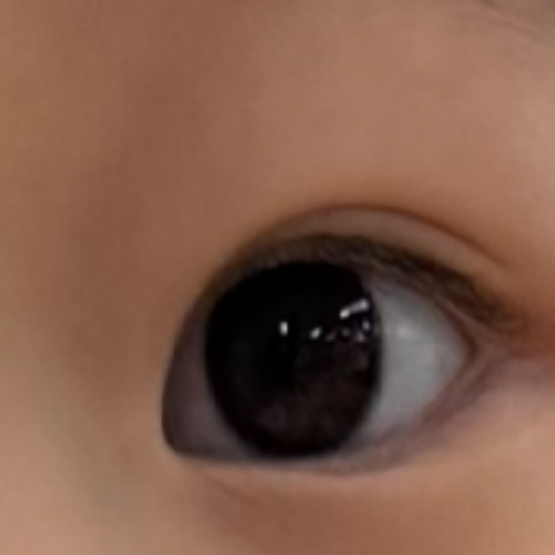 치료 후