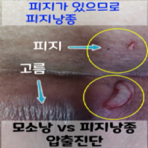 치료 후