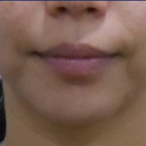 치료 후