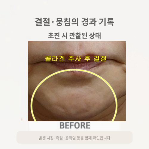 치료 전