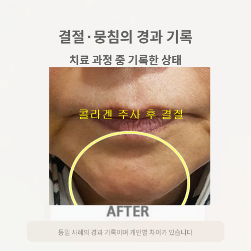 치료 후